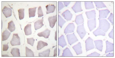Crystallin-αB (phospho Ser59) rabbit pAb - image 1