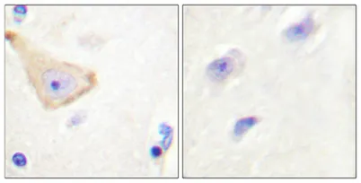 IL-3Rβ (phospho Tyr593) rabbit pAb - image 1
