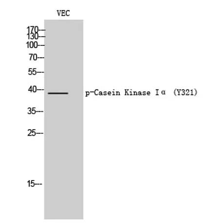 Casein Kinase Iα (phospho Thr321) rabbit pAb - image 1