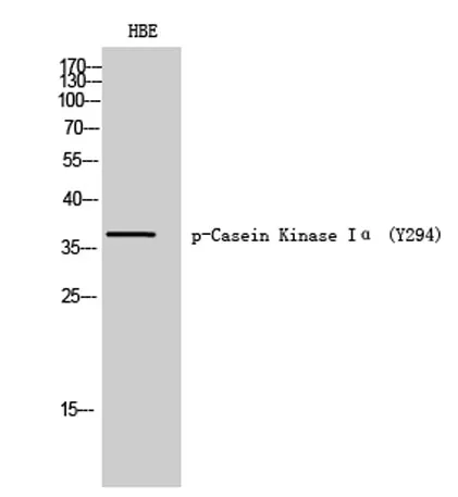Casein Kinase Iα (phospho Tyr294) rabbit pAb - image 1