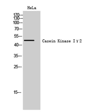 Casein Kinase Iγ2 rabbit pAb - image 1