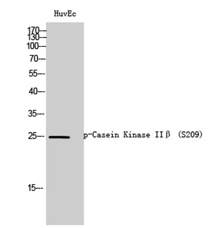 Casein Kinase IIβ (phospho Ser209) rabbit pAb - image 1