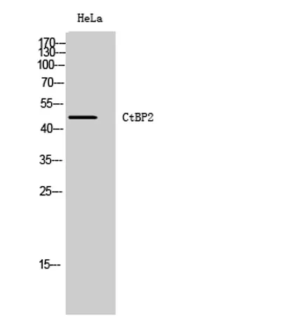 CtBP2 rabbit pAb - image 1
