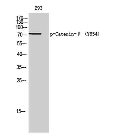 Catenin-β (phospho Tyr654) rabbit pAb - image 1