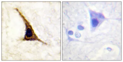 AR-β2 (phospho Ser355/S356) rabbit pAb - image 1