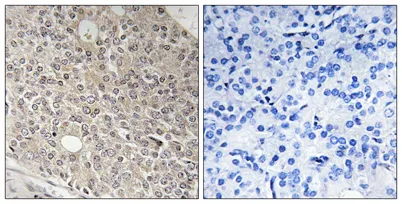 Angiomotin-L1 rabbit pAb - image 1
