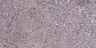 CYP2A6/7 rabbit pAb