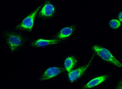 CYP17A1 rabbit pAb