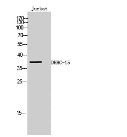 DHHC-15 rabbit pAb - image 1