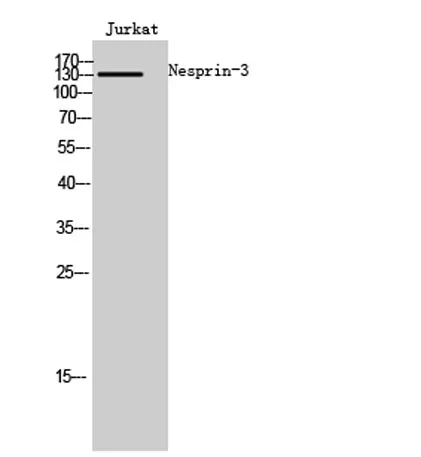 Nesprin-3 rabbit pAb - image 1