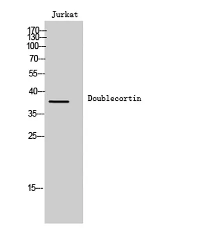 Doublecortin rabbit pAb - image 1