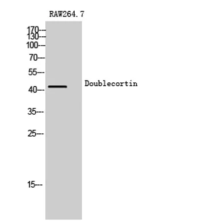 Doublecortin rabbit pAb - image 1