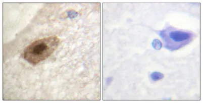 DDX3 (phospho Thr322) rabbit pAb - image 1