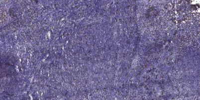 ADAMTS-17 rabbit pAb - image 1
