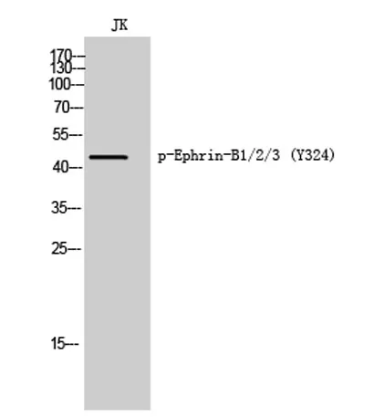 Ephrin-B1/2/3 (phospho Tyr324) rabbit pAb - image 1
