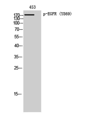 EGFR (phospho Tyr869) rabbit pAb - image 1