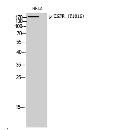 EGFR (phospho Tyr1016) rabbit pAb