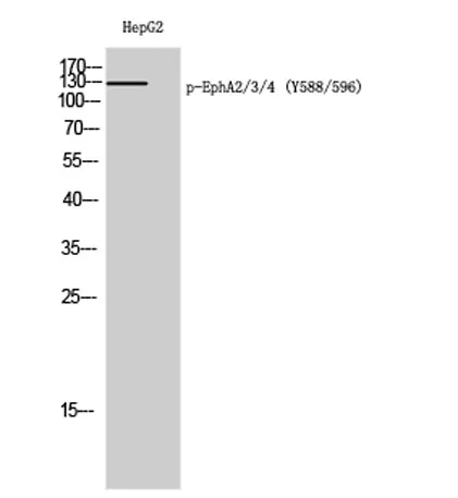 EphA2/3/4 (phospho Tyr588/596) rabbit pAb - image 1