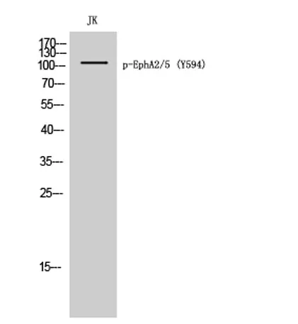 EphA2/5 (phospho Tyr594) rabbit pAb - image 1