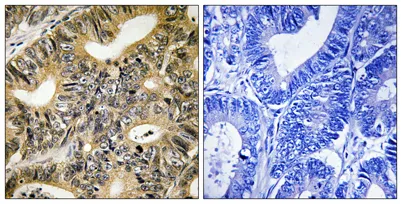 4E-BP1 (phospho Thr70) rabbit pAb - image 1