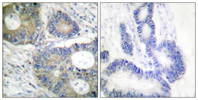 4E-BP1 rabbit pAb - image 1