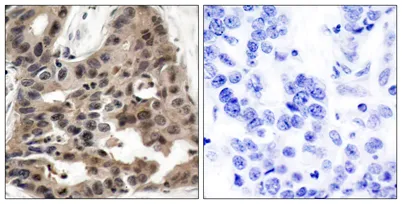 4E-BP1 rabbit pAb - image 1