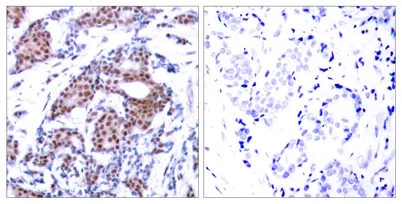 Elk-1 (phospho Ser383) rabbit pAb - image 1
