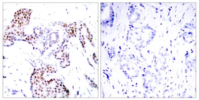 Elk-1 (phospho Ser389) rabbit pAb - image 1