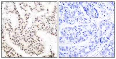 Elk-1 (phospho Thr417) rabbit pAb - image 1