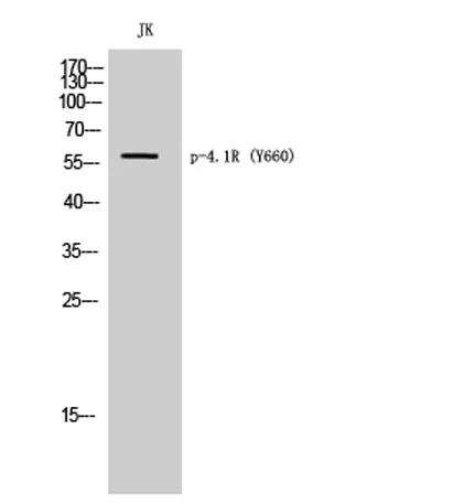4.1R (phospho Tyr660) rabbit pAb - image 1