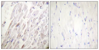 Dematin (phospho Ser403) rabbit pAb