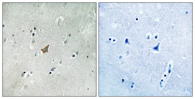 EphA3/4/5 (phospho Tyr779/833) rabbit pAb - image 1