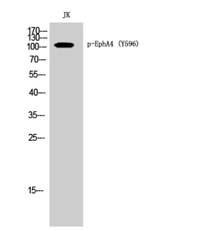 EphA4 (phospho Tyr596) rabbit pAb - image 1