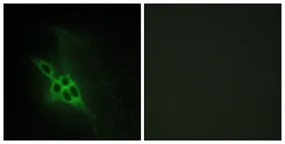 EphB1/2/3 rabbit pAb - image 1