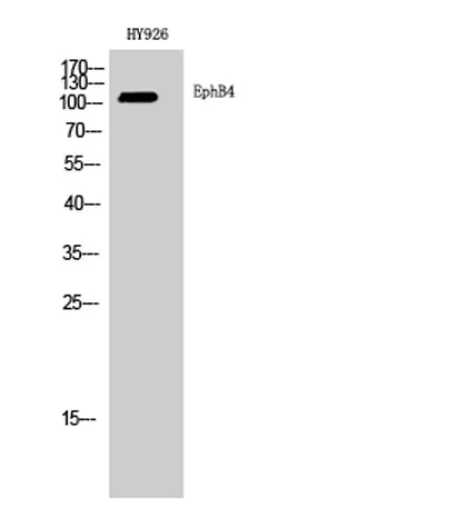 EphB4 rabbit pAb - image 1