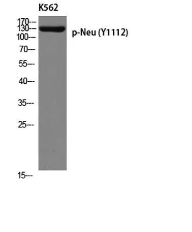 Neu (phospho Tyr1112) rabbit pAb - image 1