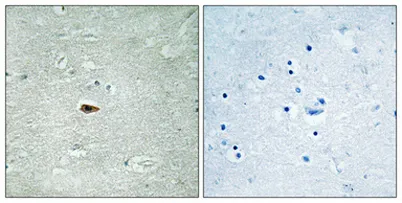 ErbB-3 (phospho Tyr1328) rabbit pAb - image 1