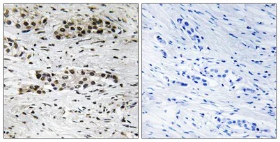ERα (phospho Ser102) rabbit pAb - image 1