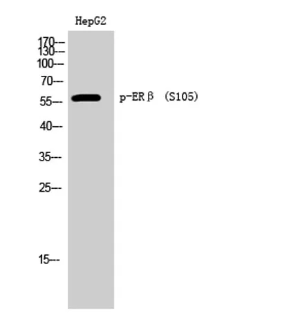 ERβ (phospho Ser105) rabbit pAb - image 1