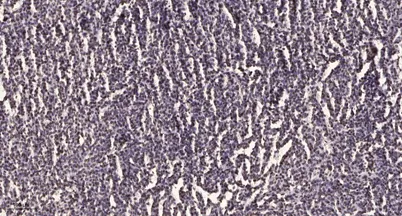 Ets-1 (phospho Ser251) rabbit pAb
