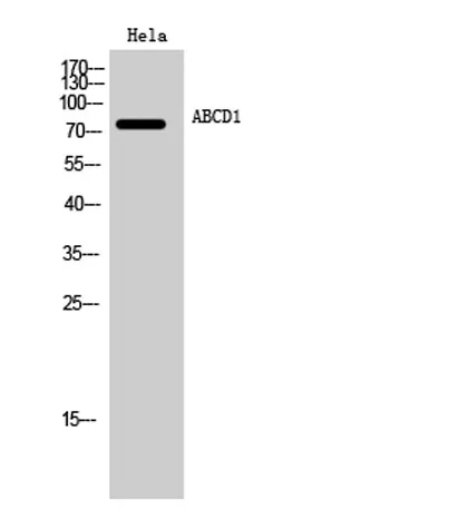 ABCD1 rabbit pAb - image 1