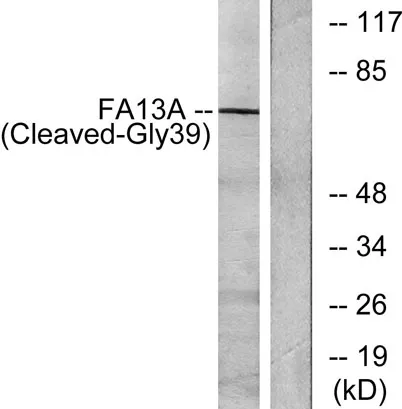 Cleaved-Factor XIIIa (G39) rabbit pAb - image 1