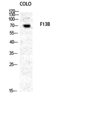 Factor XIII B rabbit pAb - image 1