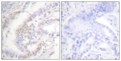 FANCD2 (phospho Ser222) rabbit pAb - image 1