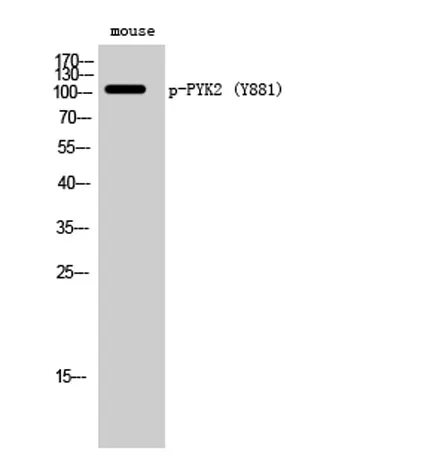 PYK2 (phospho Tyr881) rabbit pAb - image 1