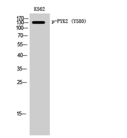 PYK2 (phospho Tyr580) rabbit pAb - image 1