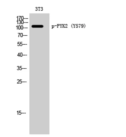 PYK2 (phospho Tyr579) rabbit pAb - image 1