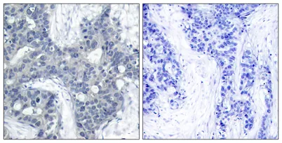 PYK2 (phospho Tyr402) rabbit pAb - image 1