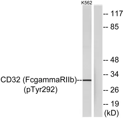 CD32 (phospho Tyr292) rabbit pAb - image 1