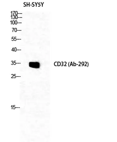 CD32 rabbit pAb - image 1
